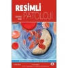 RESİMLİ PATOLOJİ