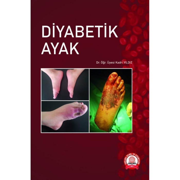 DİYABETİK AYAK