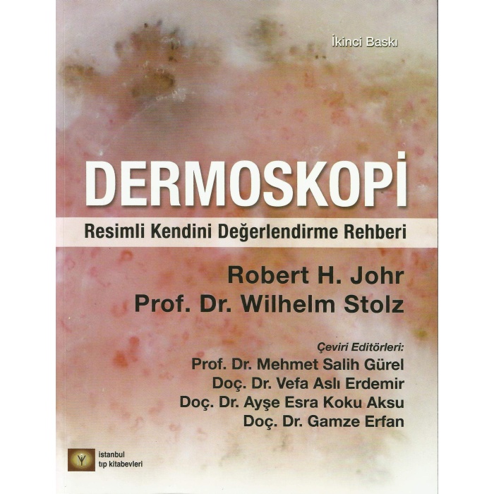 DERMOSKOPİ