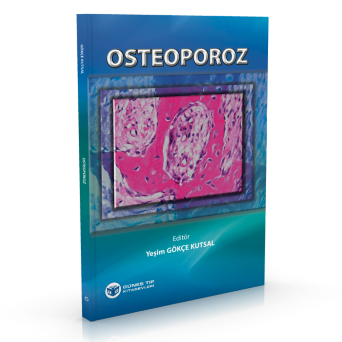 OSTEOPOROZ