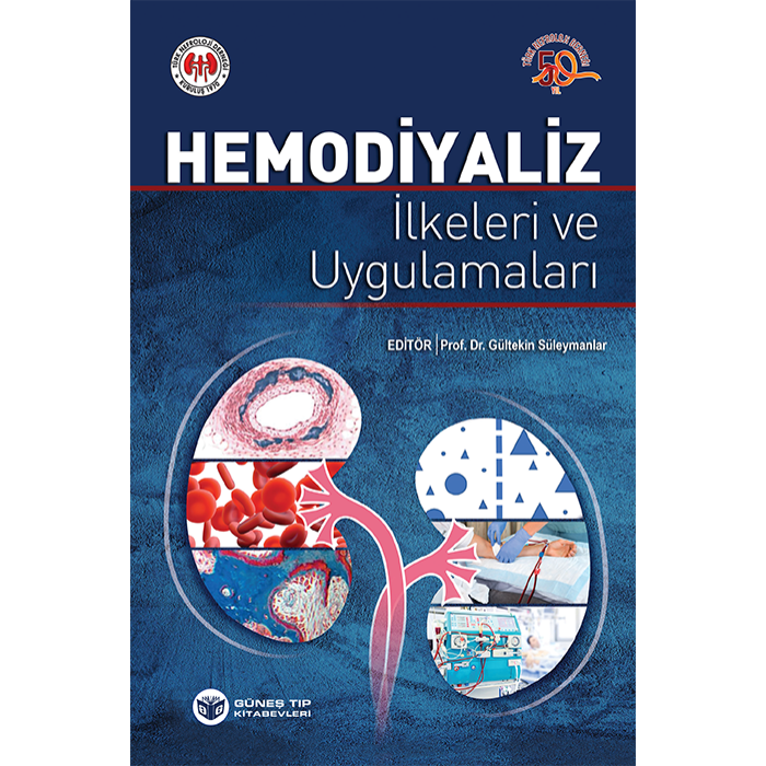 HEMODİYALİZ İLKELERİ VE UYGULAMALARI