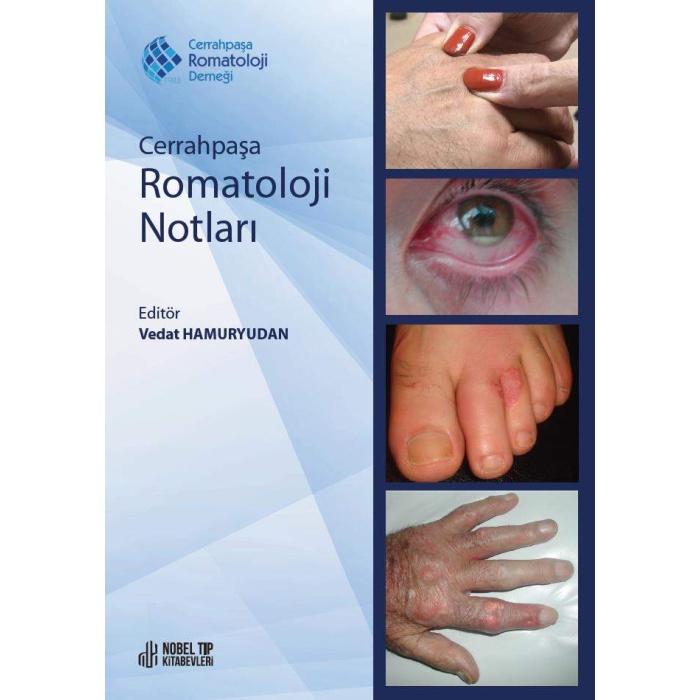 CERRAHPAŞA ROMATOLOJİ NOTLARI