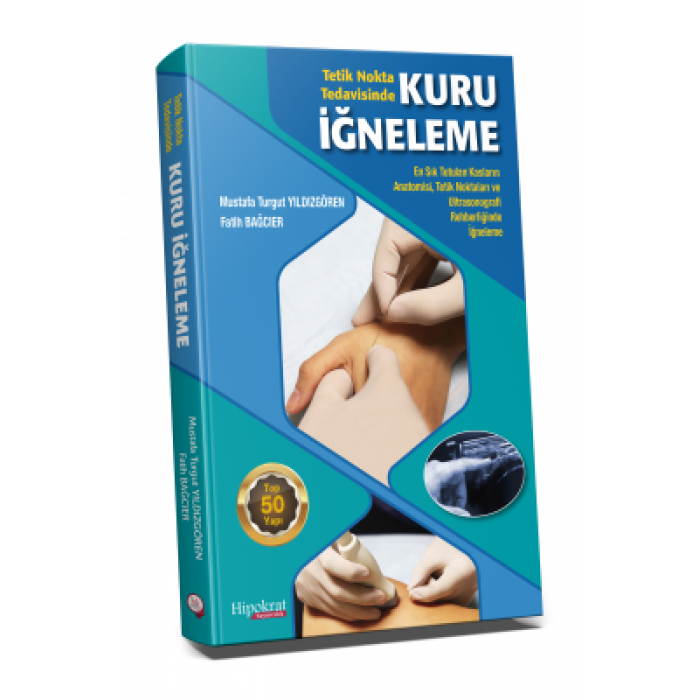 TETİK NOKTA TEDAVİSİNDE KURU İĞNELEME