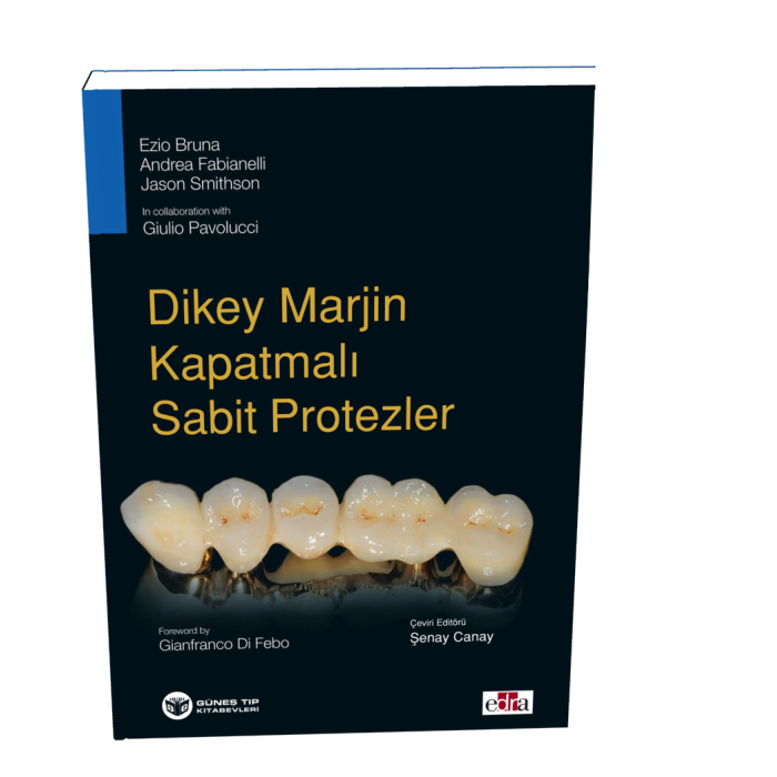 DİKEY MARJİN KAPATMALI SABİT PROTEZLER