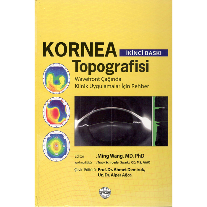 KORNEA TOPOGRAFİSİ