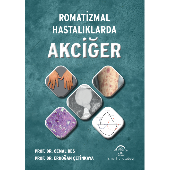 ROMATİZMAL HASTALIKLARDA AKCİĞER