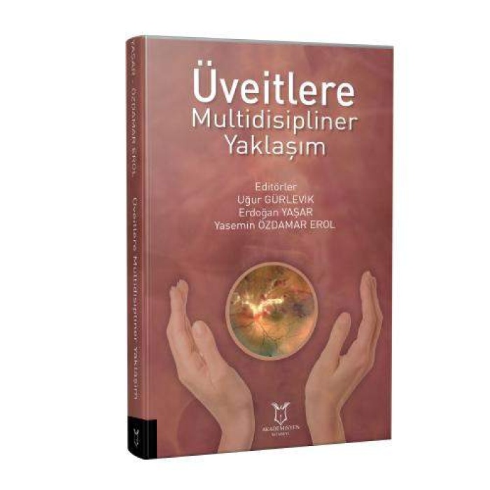 ÜVEİTLERE MULTİDİSİPLİNER YAKLAŞIM