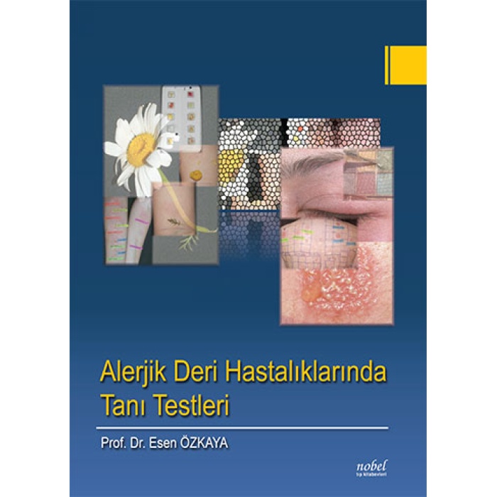 ALERJİK DERİ HASTALIKLARINDA TANI TESTLERİ