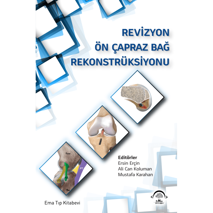 REVİZYON ÖN ÇAPRAZ BAĞ REKONSTRÜKSİYONU