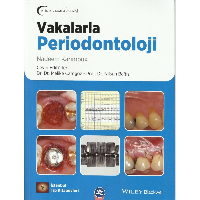 VAKALARLA PERİODONTOLOJİ