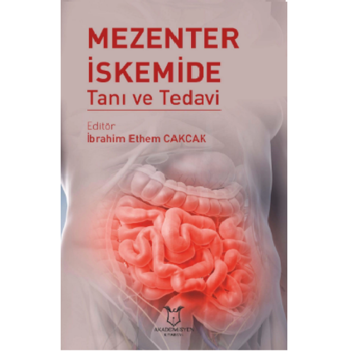 MEZENTER İSKEMİDE TANI VE TEDAVİ