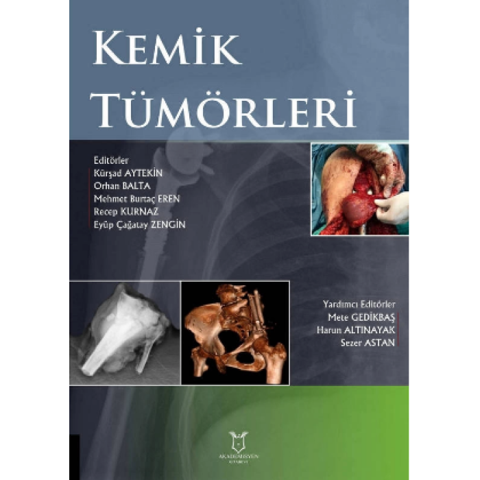 KEMİK TÜMÖRLERİ