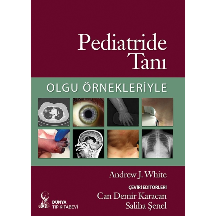 PEDİATRİDE TANI