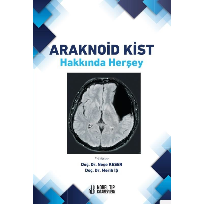 ARAKNOİD KİST HAKKINDA HERŞEY