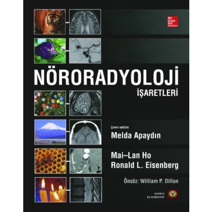 NÖRORADYOLOJİ İŞARETLERİ