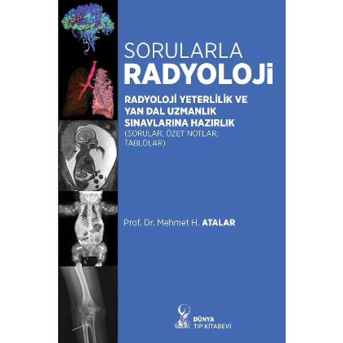 SORULARLA RADYOLOJİ