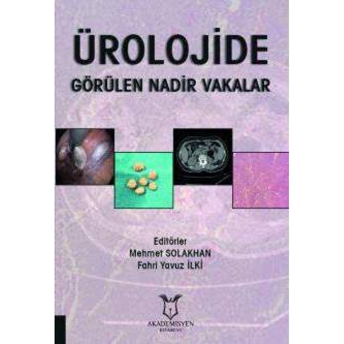 ÜROLOJİDE GÖRÜLEN NADİR VAKALAR