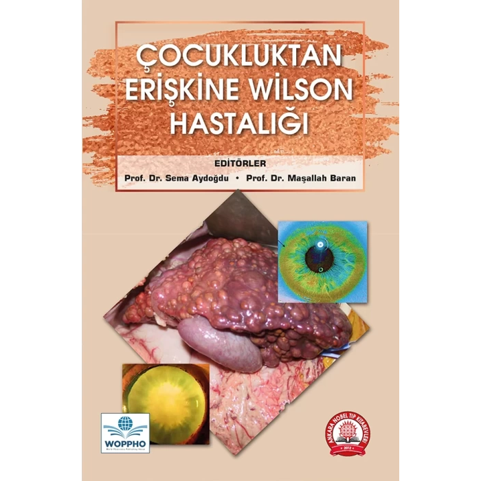 ÇOCUKLUKTAN ERİŞKİNE WİLSON HASTALIĞI