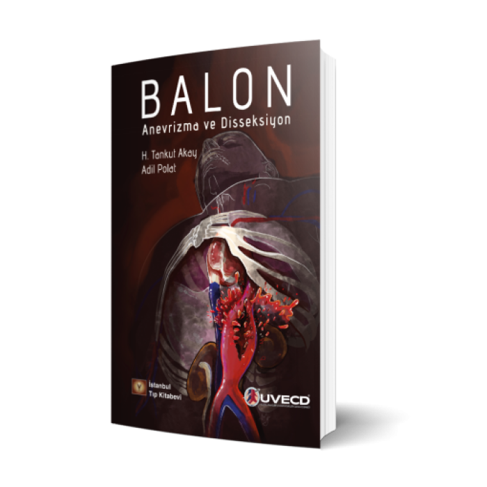 BALON ANEVRİZMA VE DİSSEKSİYON