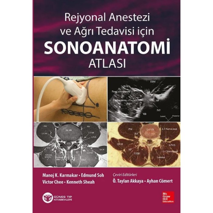 REJYONAL ANESTEZİ VE AĞRI TEDAVİSİ İÇİN SONOANATOMİ ATLASI