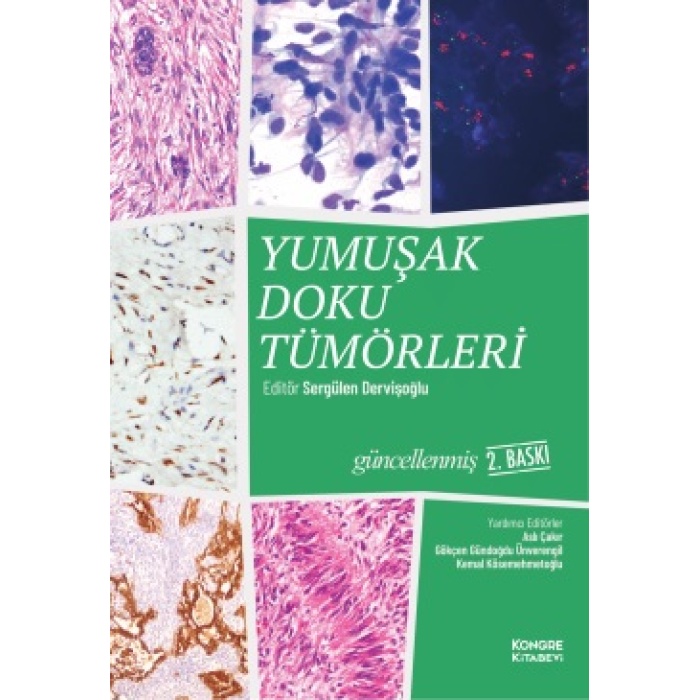 YUMUŞAK DOKU TÜMÖRLERİ