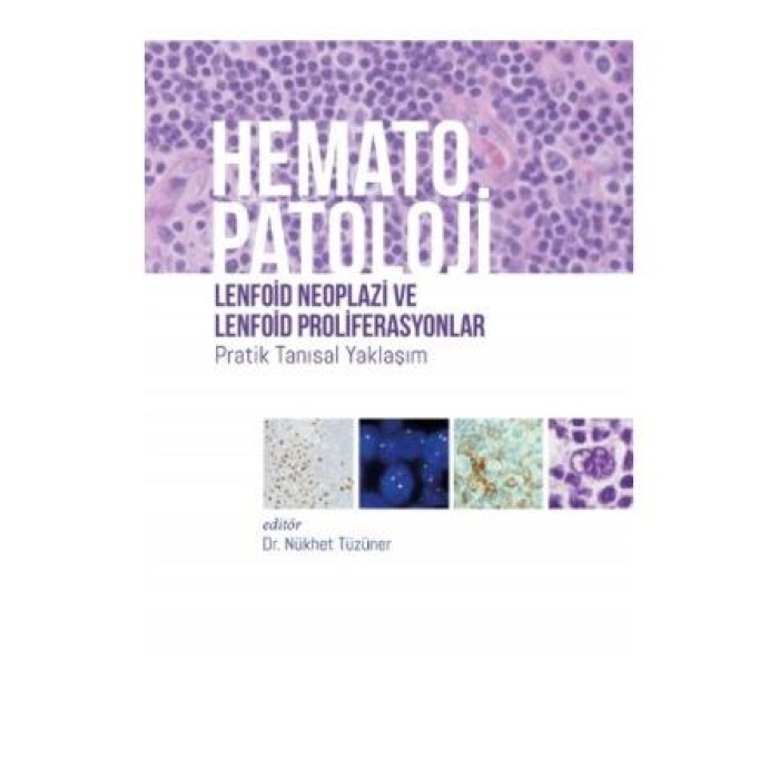 HEMATOPATOLOJİ LENFOİD NEOPLAZİ VE LENFOİD PROLİFERASYONLAR