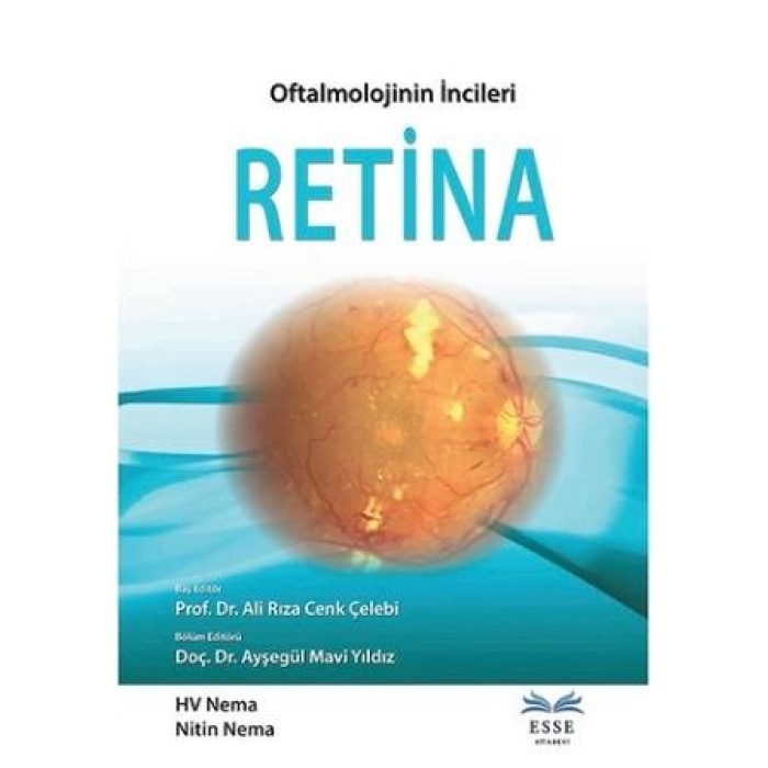 RETİNA