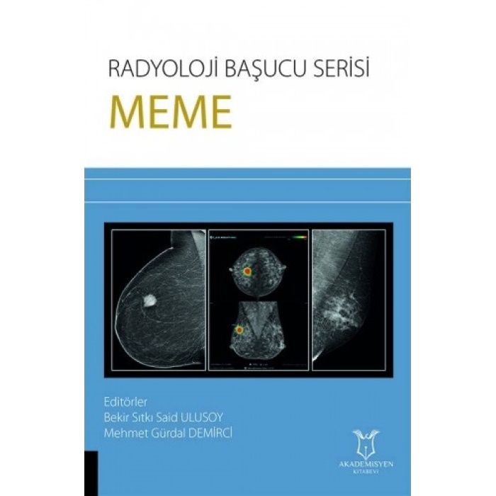 RADYOLOJİ BAŞUCU SERİSİ - MEME