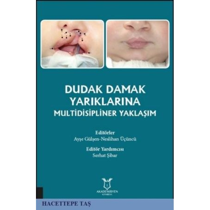 Dudak Damak Yarıklarına Multidisipliner Yaklaşım