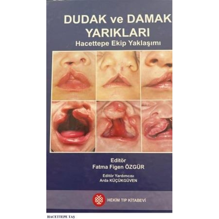 DUDAK VE DAMAK YARIKLARI HACETTEPE EKİP YAKLAŞIMI