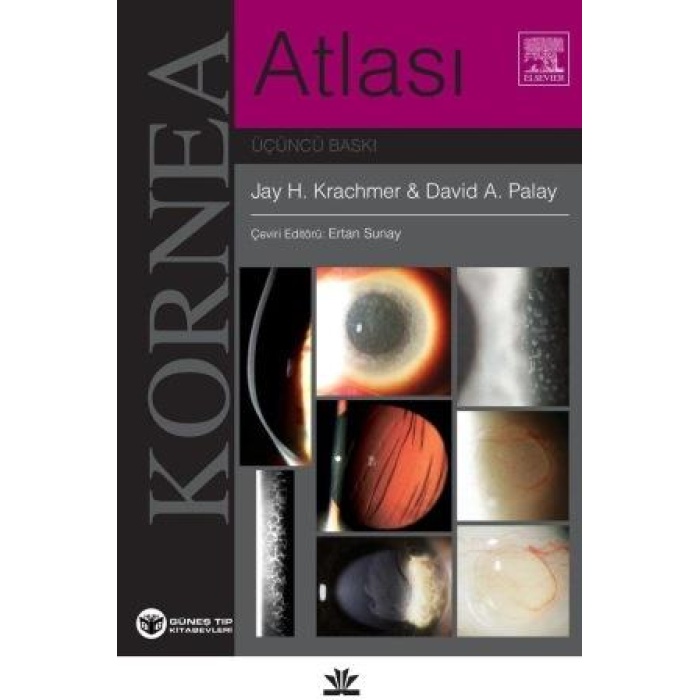 KORNEA ATLASI KRACHMER
