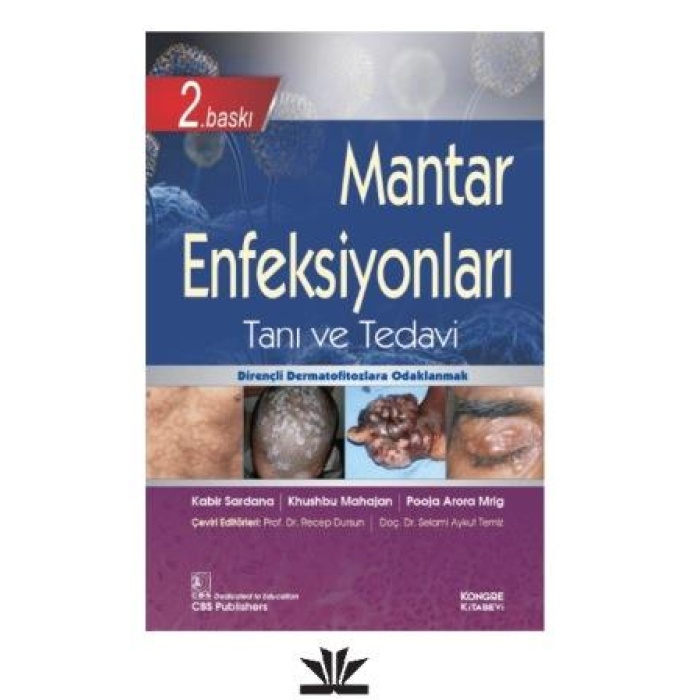 MANTAR ENFEKSİYONLARI TANI VE TEDAVİ