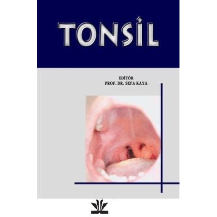 TONSİL