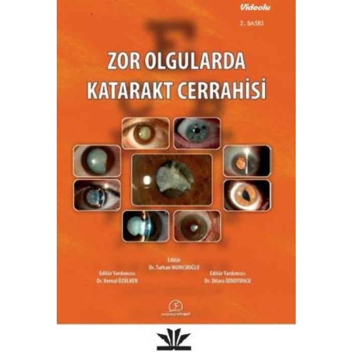 ZOR OLGULARDA KATARAKT CERRAHİSİ