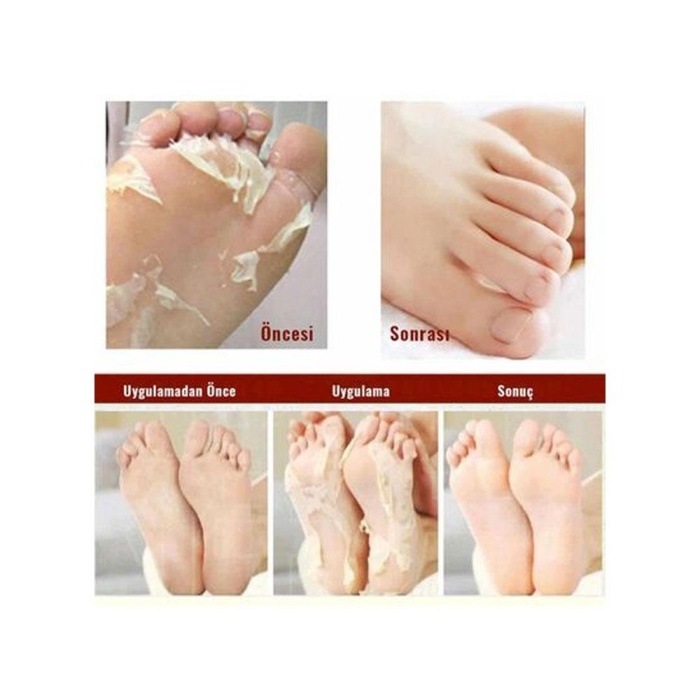 Mjcare Çorap Tipi Ayak Peeling Maske
