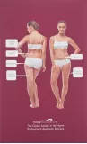 Silkn Silkn Body Selülit Azaltma Ve Sıkılaştırıcı Cilt Cihazı