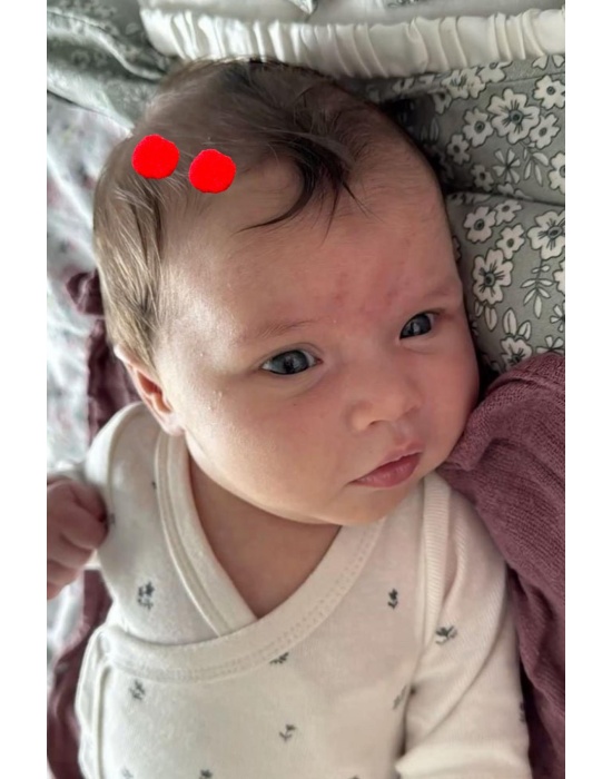 2li Kırmızı Renk Ponponlu Saçsız Bebek Tokası