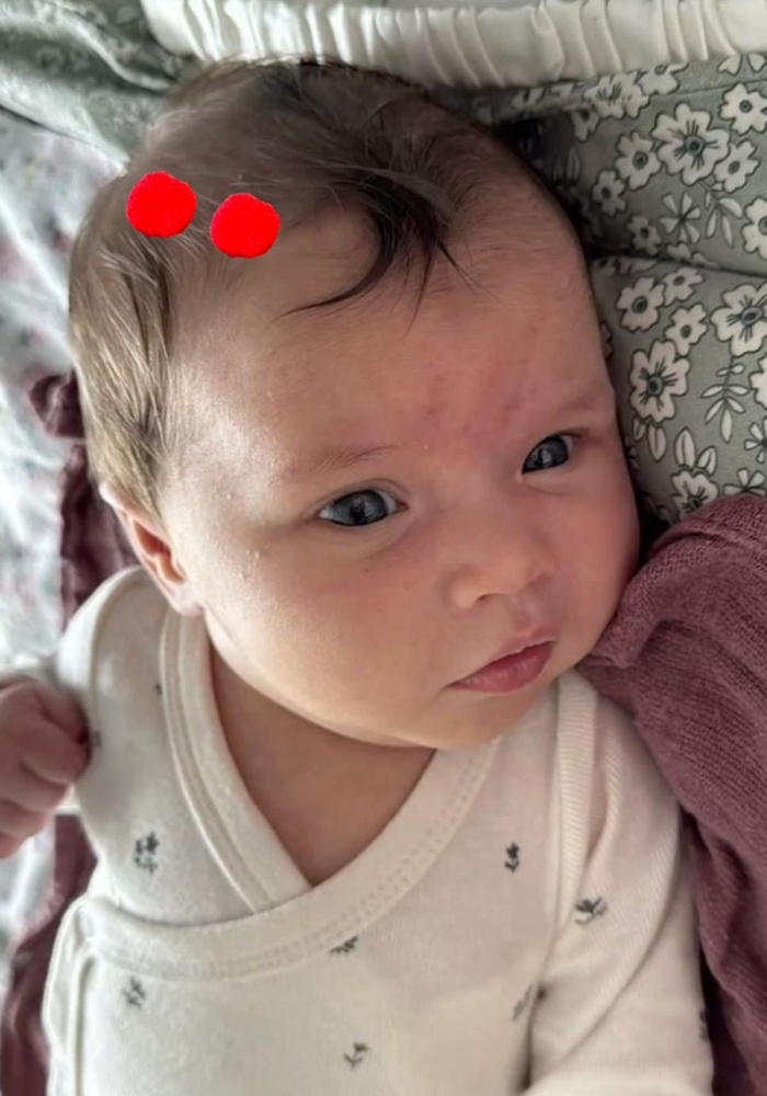 2li Kırmızı Renk Ponponlu Saçsız Bebek Tokası
