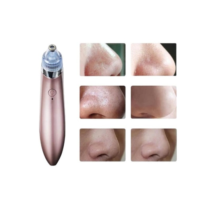 SİYAH NOKTA CİHAZI