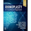 Rhinoplasty: a Case-based approach 1st Edition