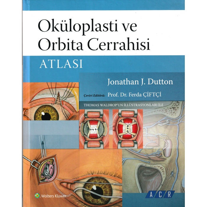 OKÜLOPLASTİ VE ORBİTA CERRAHİSİ ATLASI